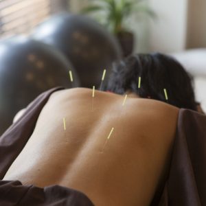 japanese female get acupuncture treatment in kyoto japan